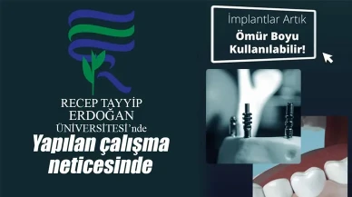 RTEÜ patentini aldı, implantlar artık ömürlük oldu