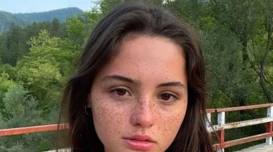 Derya Pınar Ak’ın Çilleri Gerçek mi? Makyaj mı? İşte Net Cevap