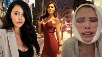 Didem Ceran Neden Yüz Nakli Yaptırdı? Güney Kore'de Hangi Operasyonları Geçirdi?