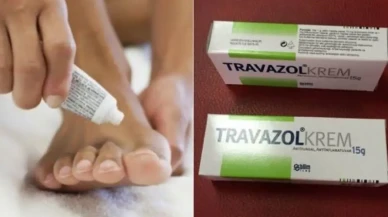 Travazol Krem Ne İşe Yarar? Travazol Krem Ne İçin Kullanılır?