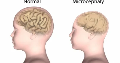 Halilişko'nun annesinin adı ne? Halilişko Hastalığı nedir? Ayşe Koşar'ın kocasının adı ne? Halilişko'nun kaç kardeşi var?