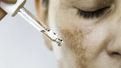 Güneş Lekelerinden Kurtulmanın Yolları: Doğal Maskeler ve Peelingler Etkili Mi?