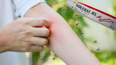 Solerat jel nedir ve Solerat jel ne için kullanılır? Solerat jel fiyatı 2024