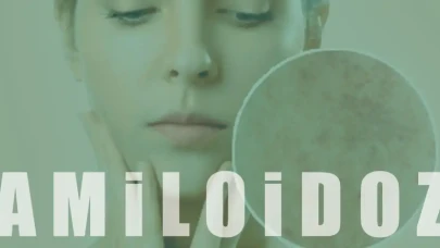 Amiloidoz Nedir? Organlarda Protein Birikiminin Etkileri ve Tedavisi