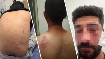 Kürtçe konuşanlara ırkçı saldırıda bulunanlar serbest bırakıldı