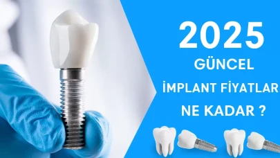 İmplant Fiyat 2025 | Devlet ve Özel Hastane Güncel Ücretleri