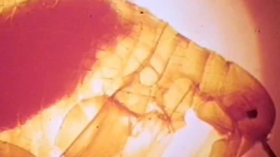 Milyonlarca Can Alan Salgın ABD'de Tespit Edildi!