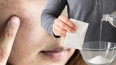 İbn-i Sina'nın Tarifiyle Patlıcan Moru ile Cilt Lekelerine Doğal Çözüm: Sirkeyle Hazırlayın, Uygulayın!