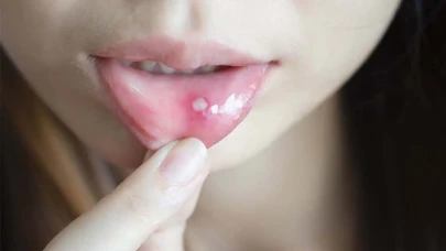 Piraldyne: Kullanım Alanları ve Faydaları