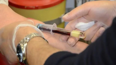 Oruçluyken Kan Almak ve Hacamat Rize’de Nasıl Değerlendiriliyor?