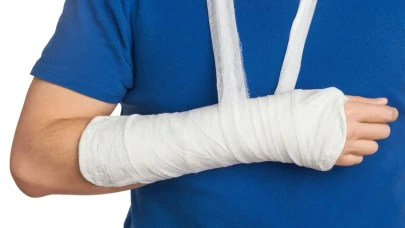 Kırık Belirtileri: İşaretleri Tanımanın Yolları