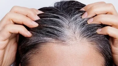 Beyaz Saç Sorununa Kuaförsüz Çözüm: Yeni Yöntemler Gündemde!