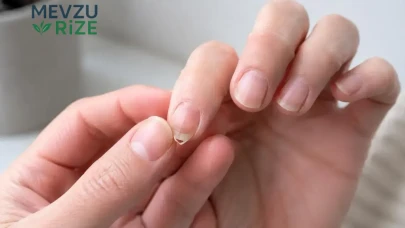 Tırnakların Hızla Uzanmasını Sağlayan İki Malzemeli Bakım Tüyosu!
