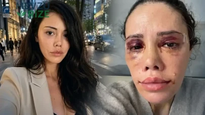 Didem Ceran'ın Yüz Nakli Kararı: Survivor Eski Yarışmacısından CİMER Açıklaması Geldi