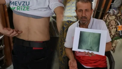 Platinleri Sökme İşlemi Sonrası Beklenmedik Kaza: İki Çocuk Babası Adam Evde Mahsur Kaldı!