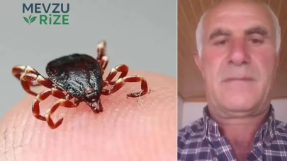 Vücudundaki Keneyi Kendisi Çıkardı, 4 Gün Sonra Hayatını Kaybetti