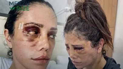 Didem Ceran, Estetik Operasyon Sonrası Şok Edici Açıklamalar Yaptı!