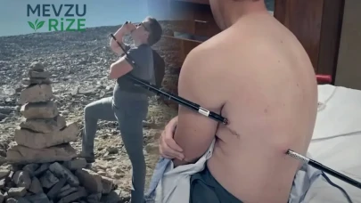 Doğa Yürüyüşü Korku Dolu Anlarla Dolu! Vücuduna Saplanan Batonla 6,5 Saat Boyunca Yürümek Zorunda Kaldı!