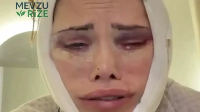 Didem Ceran'ın Estetik Yolculuğu: Güney Kore'deki Deneyimleri ve Sağlık Durumu Hakkında Son Gelişmeler