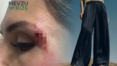 Geniş Paçalı Pantolonlar Hakkında Şaşırtan İddialar: Moda Dünyasında Tartışmalar Alevlendi