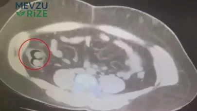 Kars'ta yakalanan kuryenin midesinden 76 kapsül uyuşturucu çıktı