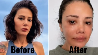 Didem Ceran Kimdir? Kaç Yaşında, Neden Yüz Nakli Oldu?