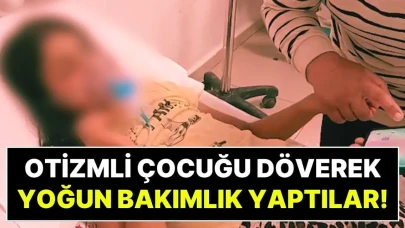 Elmas Yağmur Kimdir? Dövülen Otizmli Çocuk Nasıl?