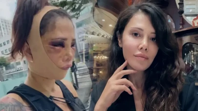 Survivor Didem Ceran'ın Güney Kore'de geçirdiği estetik operasyon sonrası yeni bir ameliyat gündeme geldi!