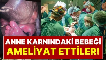 Anne Karnındaki Bebeği Ameliyat Ettiler