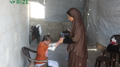 Gazze'de nadir cilt hastalığıyla mücadele eden genç kız: İyileşip elbise giymenin hayalini kuruyorum