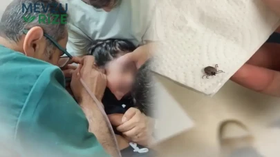 Bir aydır süren kulak ağrısının altından çıkan gerçek şoke etti! Kulağından canlı kene çıkarıldı
