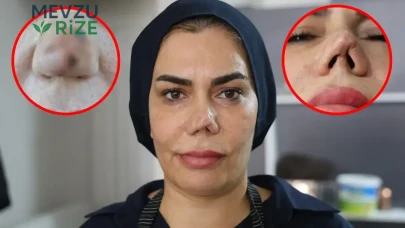 Ameliyat Sonrası Hayatı Değişen Hastanın Doktora Dava Açma Kararı Alması!