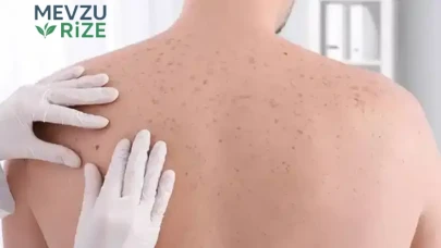 İyileşmeyen yaralara dikkat : Cilt kanserinin habercisi olabilir
