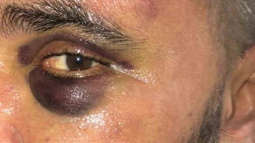 Afyonkarahisar'da İsyeri Sahibi Dükkanında Öldüresiye Darp Edildi