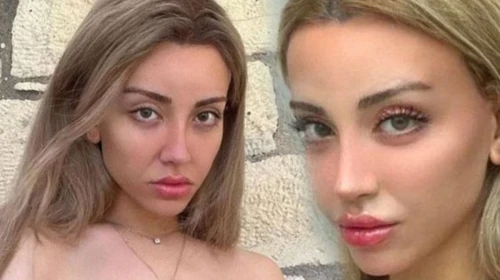 Mika Raun hastaneye başvurdu: Karın ağrısı ve kanama şikayeti