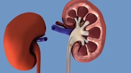 Böbrek Stentinin Ardından Görülen Kritik Belirtiler: Takipte Olun!