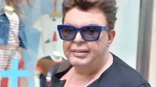 Yüz Gerdirme Operasyonu Geçiren Kuşum Aydın Eleştirilere İsyan Etti!