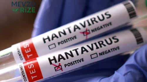Hantavirüsün ilk belirtileri neler? Sessiz başlıyor, hayati tehlikeye dönüşebiliyor!