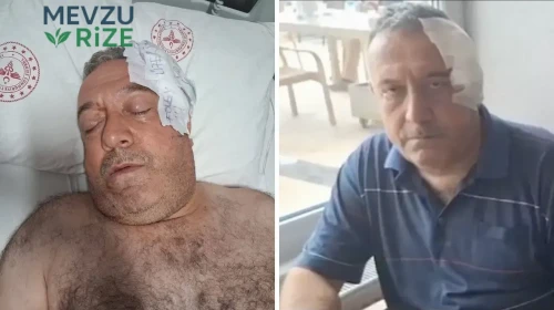 Aşı Hatırlatması Yapan Sağlık Görevlisine Saldırı: Yumruklu Saldırı Olayı!