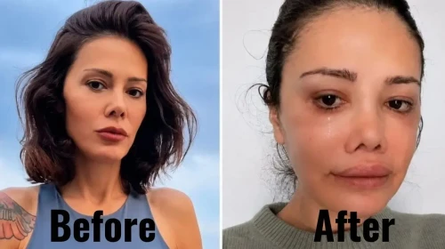 Didem Ceran Kimdir? Kaç Yaşında, Neden Yüz Nakli Oldu?
