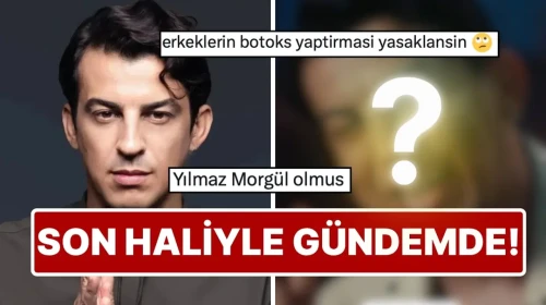 Norm Ender'in Yeni Klip Görüntüleri Telaşlandırdı: Botoks Spekülasyonları Gündeme Geldi!