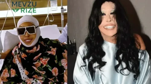 Bülent Ersoy ne estetiği yaptırdı? Estetik sonrası Bülent Ersoy'un yeni görünümü nasıl oldu?