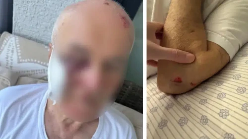 Kartal'da Tehlikeli Oyun Uyarısı Tartışmaya Sebep Oldu: 75 Yaşındaki Emekli Başkomiser Darp Edildi, Şüpheli Tutuklandı!