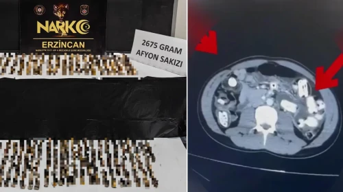 Zehir tacirlerinin mide yöntemi: İki kilo 675 gram tespit edildi