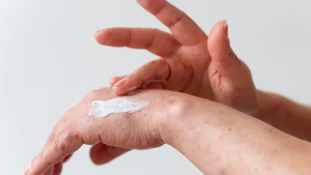 Kuru, çatlayan eller ve zayıf tırnaklar için 3 etkili ev bakımı